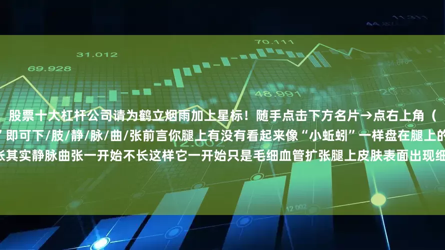 股票十大杠杆公司请为鹤立烟雨加上星标！随手点击下方名片→点右上角（…）弹出菜单栏→点“设为星标”即可下/肢/静/脉/曲/张前言你腿上有没有看起来像“小蚯蚓”一样盘在腿上的东西这个啊大概率就是静脉曲张其实静脉曲张一开始不长这样它一开始只是毛细血管扩张腿上皮肤表面出现细细的红血丝或网状的血管腿开始有一点点肿甚至更早的时候只是站久了会觉得腿特别酸胀特别疲惫但是静脉曲张你别以为症状不严重就不去理它因为静脉
